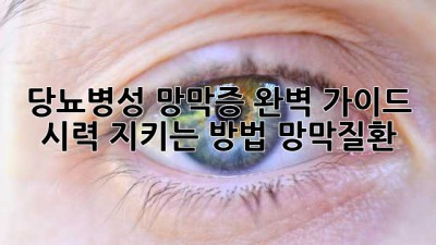 당뇨병성 망막증 완벽 가이드 👁️ 시력 지키는 방법! #망막질환